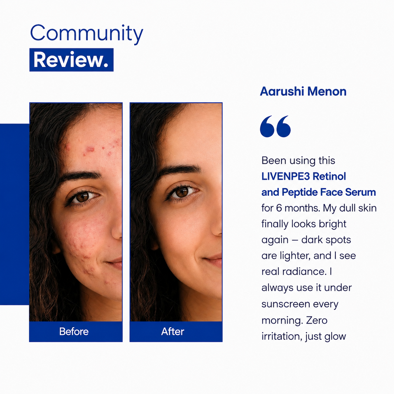 Retinol + Peptide Serum