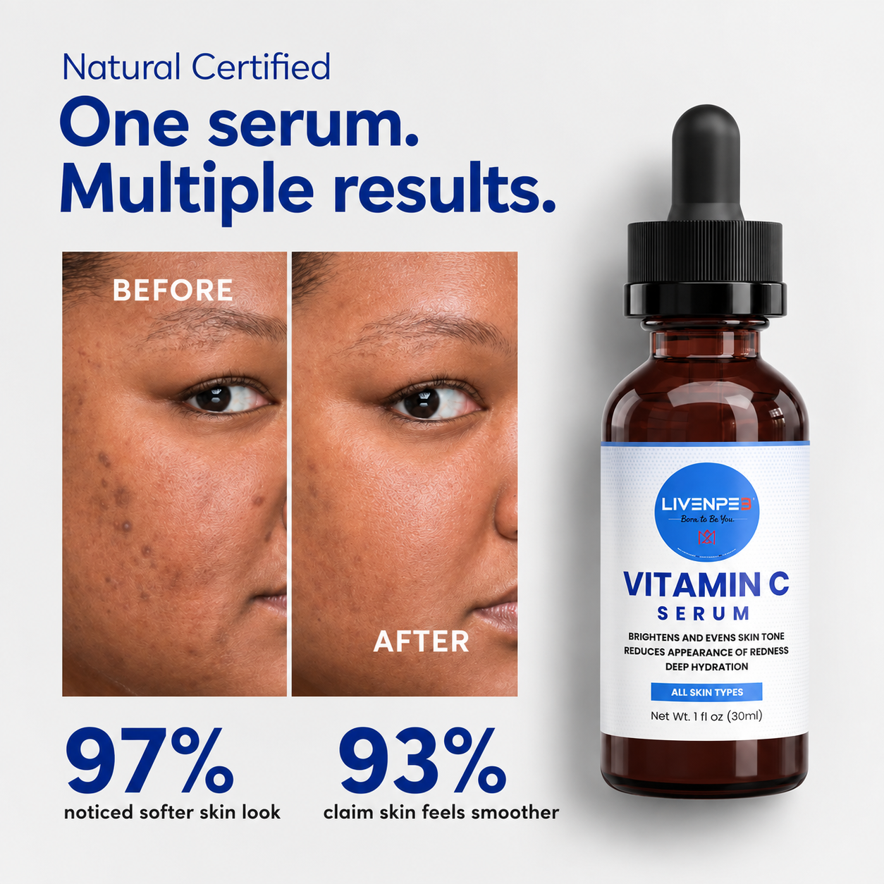 Vitamin C Serum